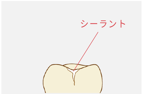 動揺度検査イメージ