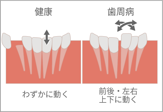動揺度検査イメージ