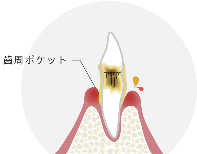 インプラントやデジタルシミュレーションの画面