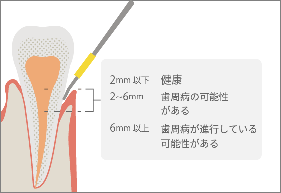 動揺度検査イメージ
