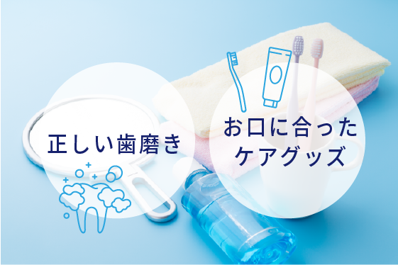 歯周ポケット検査イメージ